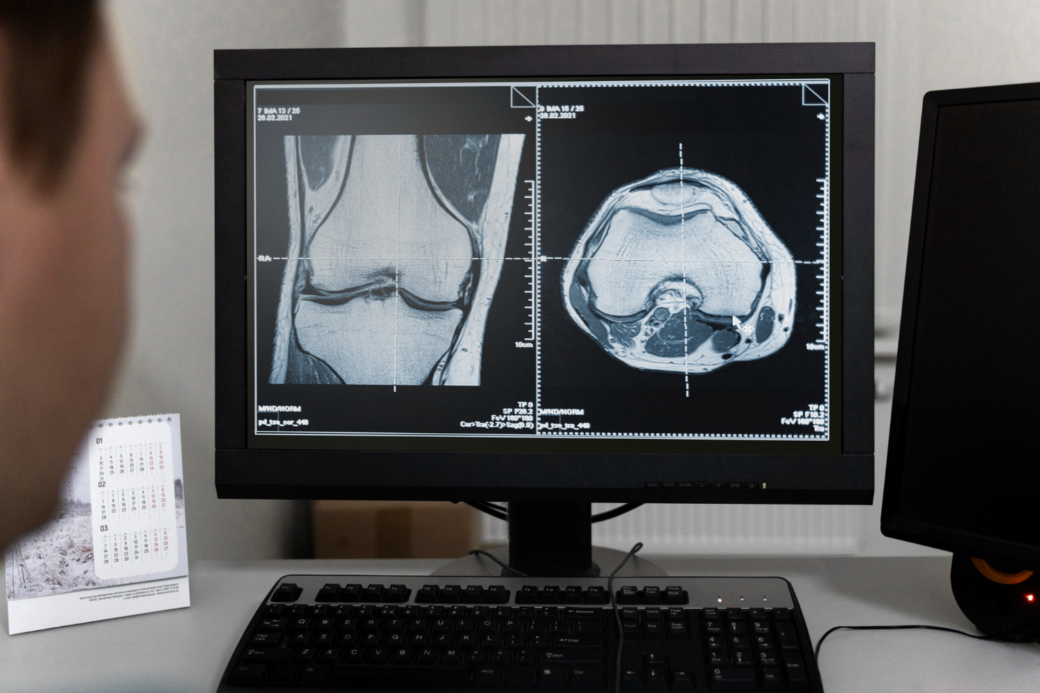 Como a IoT está revolucionando os equipamentos de imagem médica Como a IoT está revolucionando os equipamentos de imagem médica