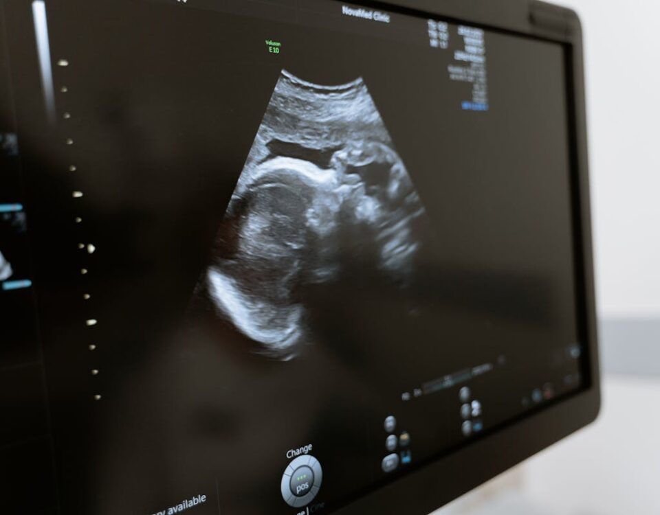 Tecnologia no acompanhamento pré-natal: as novidades para 2025 Free stock photo of 3d scanning, 3d ultrasound, analysis