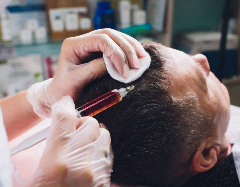 Tecnologia está revolucionando os transplantes capilares? Tecnologia está revolucionando os transplantes capilares?