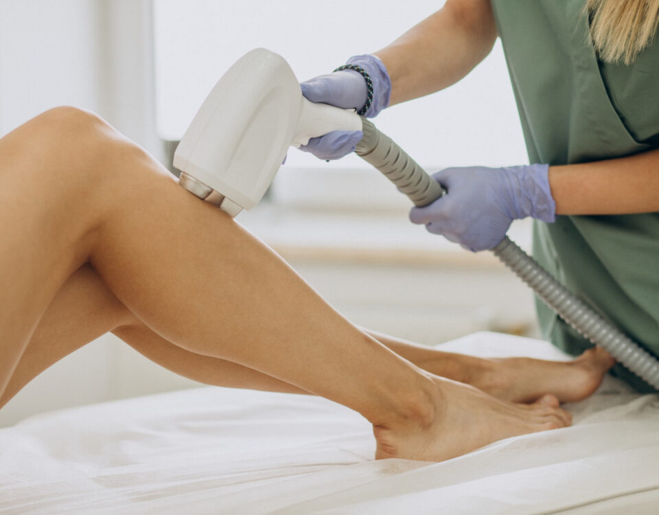 Lasers, espumas e IA: o novo arsenal contra varizes Lasers, espumas e IA: o novo arsenal contra varizes